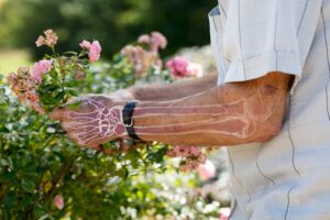 Osteoporosis Presentation and Q&A in October